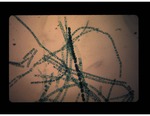 Spirogyra with zygotes, chloroplasts (10) by Carolina Biological Supply Company