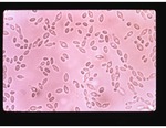 F11 Yeast Cells Isolated from Gruits of Grape by Carolina Biological Supply Company